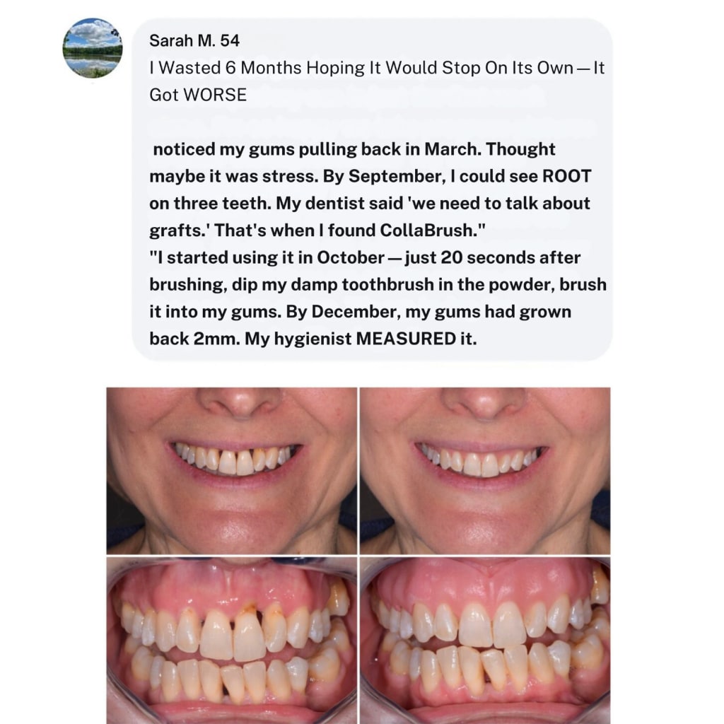 Flash Teeth Whitening