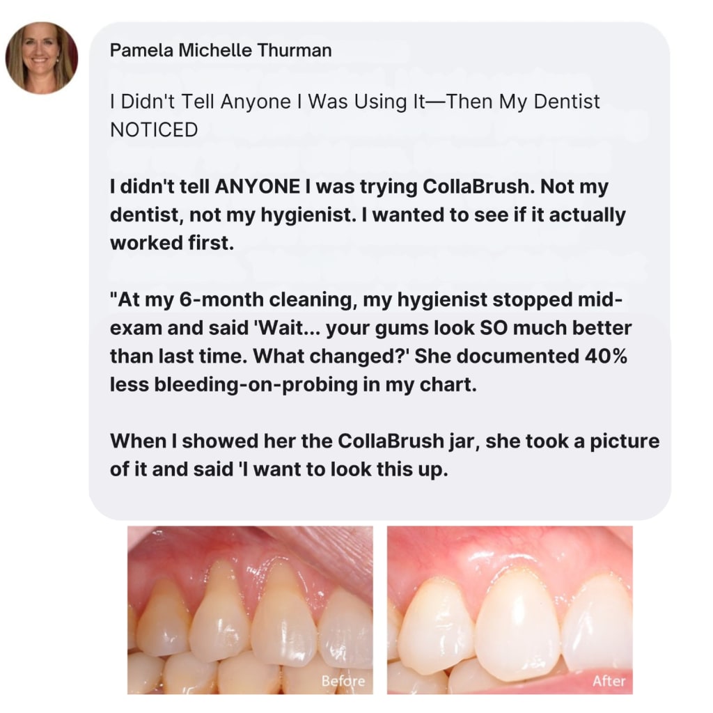 Flash Teeth Whitening