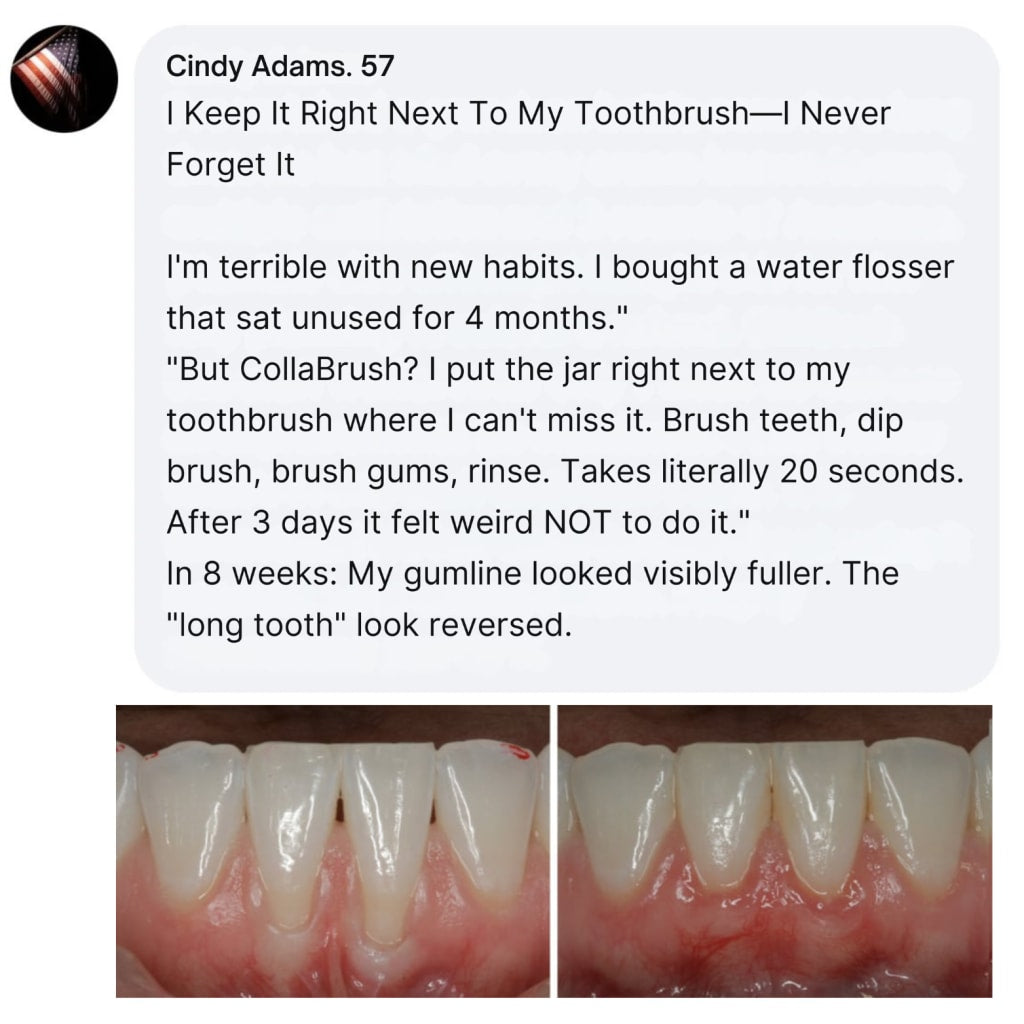 Flash Teeth Whitening