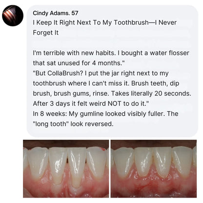 Flash Teeth Whitening